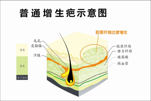 祛疤痕的最好方法小窍门，孩子受伤后留下疤痕