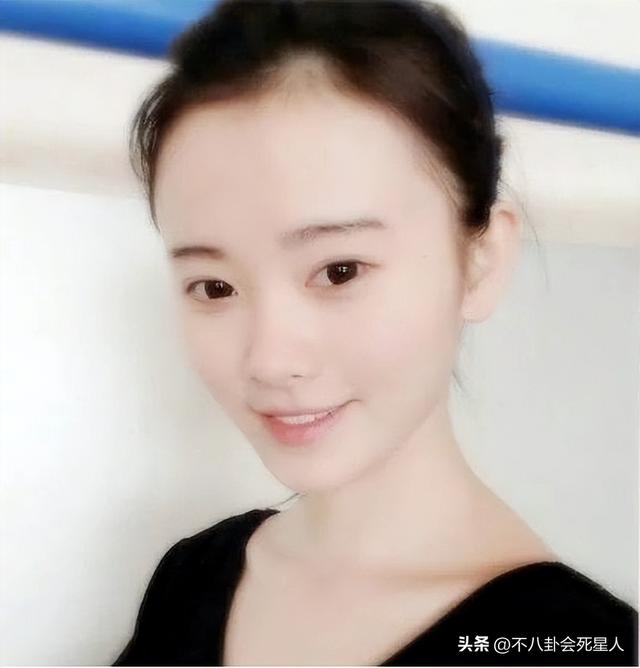 杨幂的发际线是什么样的，14位明星增发妙招