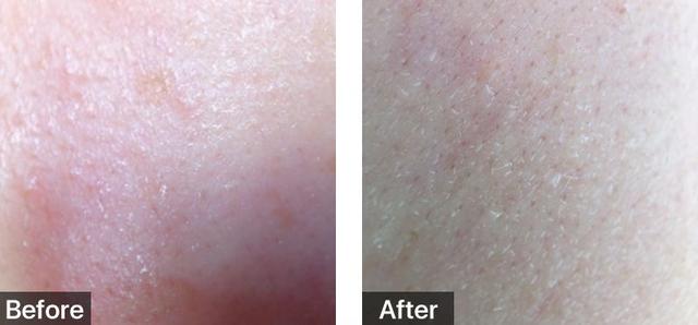 脸部能天天热敷吗，热敷脸有哪些功效与作用（面膜可以天天敷吗）