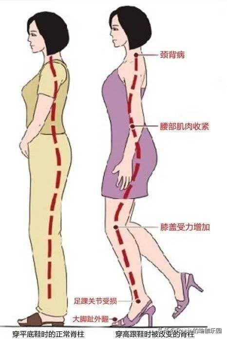 腿太粗怎么细下来最快(公认瘦小腿最有效的方法)插图(16)