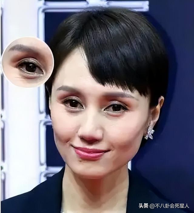 眼睛亮的人有灵气，眼睛有灵性的女人（却“败”在眼皮的明星）