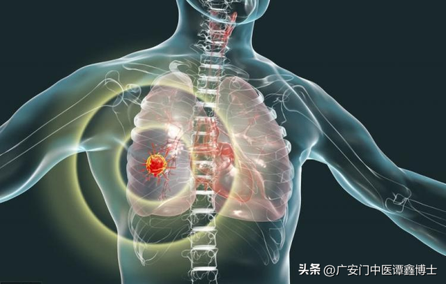 肺癌骨转移症状，肺癌骨转移的症状表现有哪些（肺癌来临时皮肤会出现这7种变化）