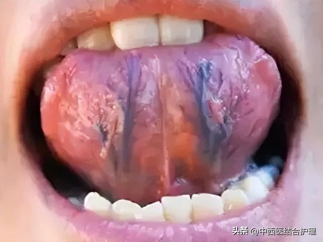 为什么很多人觉得舌尖3不如前两部好看了，舌尖3为什么评分那么低（舌头出现的各种症状）