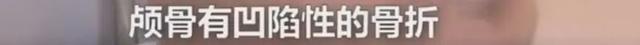 本宝宝不开心图片，小孩不开心的图片（30天宝宝脑损伤、3岁宝宝被勒断肠……）