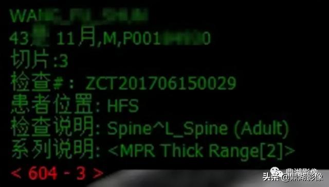 r和l哪个是左哪个是右，袜子r和l哪个是左哪个是右（竟然包含了这么多的信息）