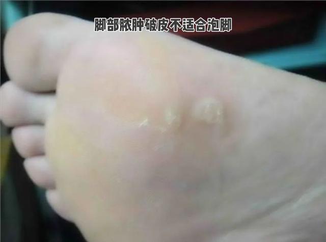 如何选购泡脚桶，如何选购泡脚桶子（电动泡脚桶的潜在危险你必须知道）