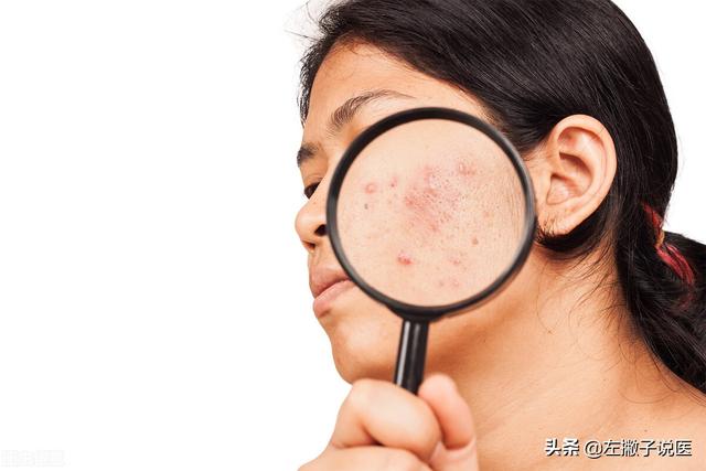 韭菜吃多了会怎么样，韭菜吃多了会上火吗（特别提醒：5类人不宜食用）