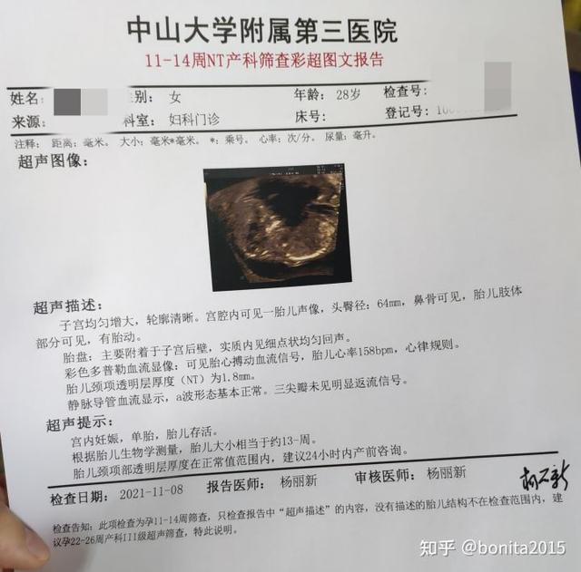 怀孕全过程是怎样的，怀孕的全程过程（2021年-2022年广州产检深圳生娃全流程）