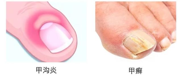 做美甲和涂指甲油哪个危害大，涂指甲油和做指甲哪个危害大（竟隐藏着这么多的风险）