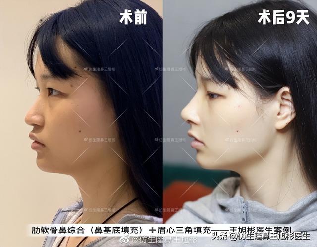 高级脸是什么意思，6种脸型不显老（“月亮脸”逆袭“高级脸”的不二法则是）