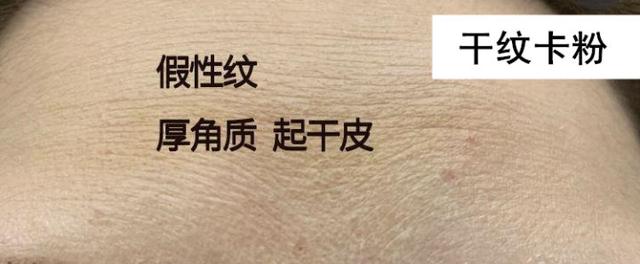 脸部能天天热敷吗，热敷脸有哪些功效与作用（面膜可以天天敷吗）