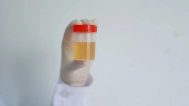 老人味是什么原因引起的，年轻人身上有老人味的原因（这3种味道都有诱因）