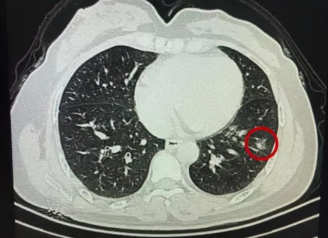 乌鸡汤是发物吗，发物最厉害的十种食物（这些“发物”建议少碰）