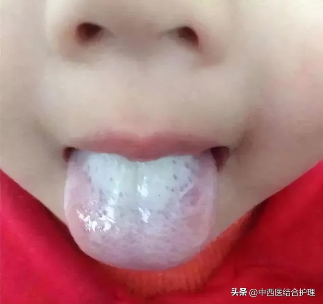 为什么很多人觉得舌尖3不如前两部好看了，舌尖3为什么评分那么低（舌头出现的各种症状）