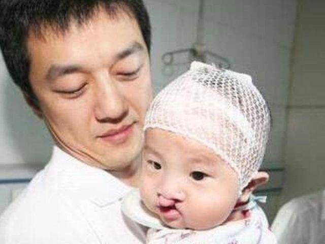 王菲怀孕4个月时，医生就告诉她孩子是兔唇，如今女儿整容花百万