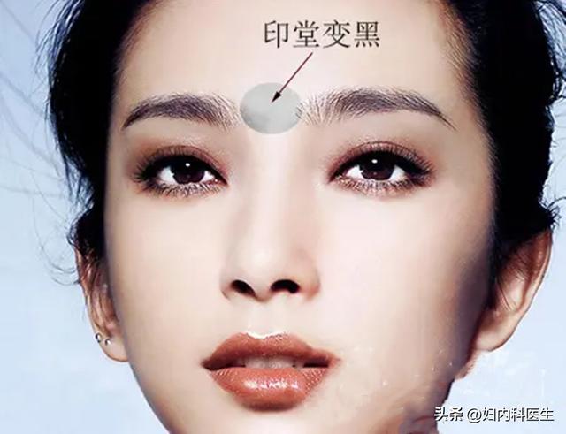 脸黑是什么病，脸黑是什么病症（如何通过脸色表情判断身体的毛病）