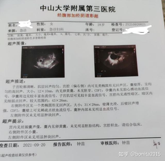 怀孕全过程是怎样的，怀孕的全程过程（2021年-2022年广州产检深圳生娃全流程）