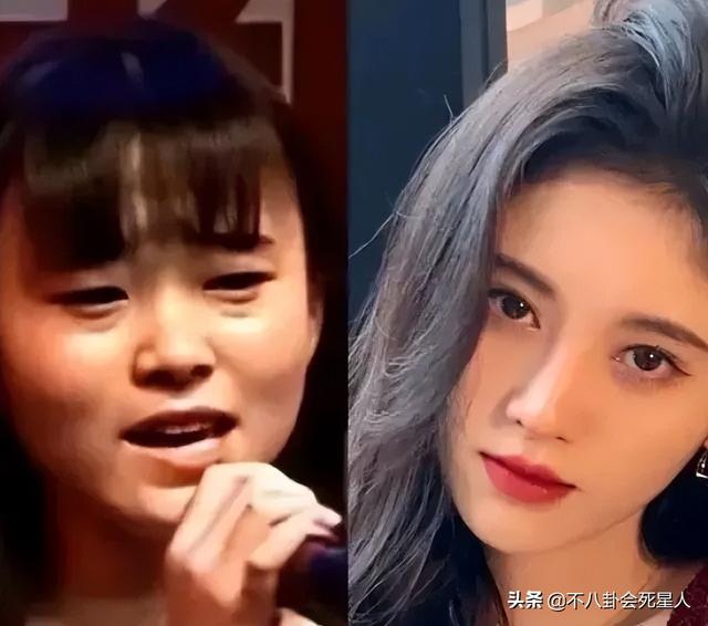 整容后遗症有哪些，整容后遗症有哪一些（明星整容后遗症明显）