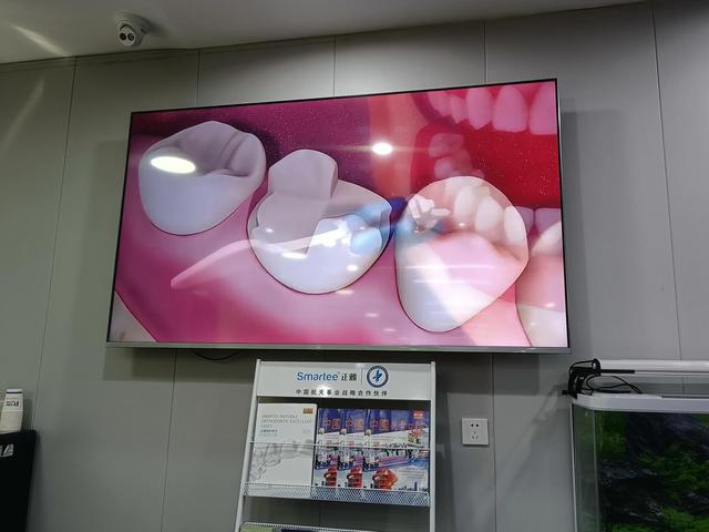 一般补牙需要多少钱，补牙需要多少钱门牙裂了（4000补一颗牙齿你觉得贵吗）