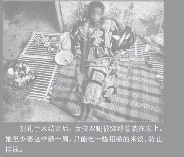 什么叫割礼，什么叫割礼手术（1.3亿人遭受的割礼之痛）