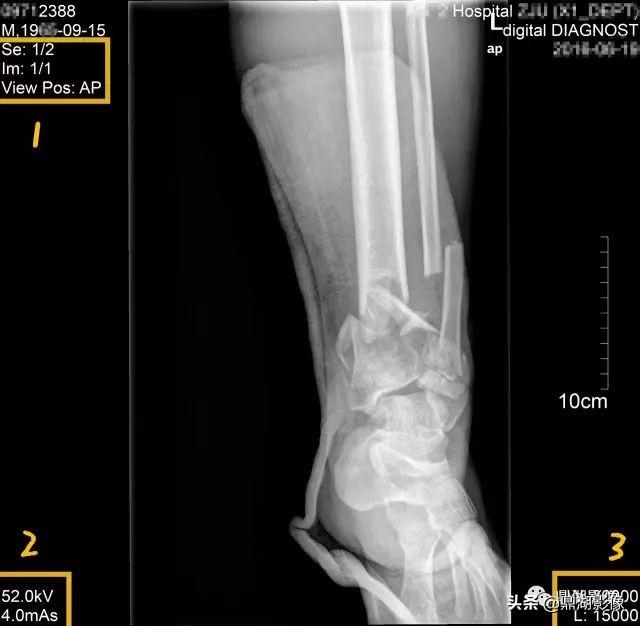 r和l哪个是左哪个是右，袜子r和l哪个是左哪个是右（竟然包含了这么多的信息）