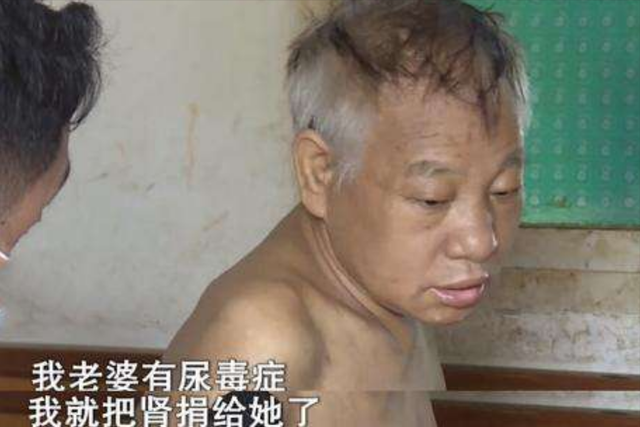 捐肾有什么危害，捐肾有什么坏处（偶然生病去医院发现肾都在）