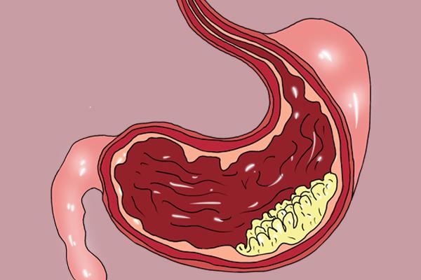 多喝水有四大好处，喝水的好处和重要性介绍（对身体是好还是坏）