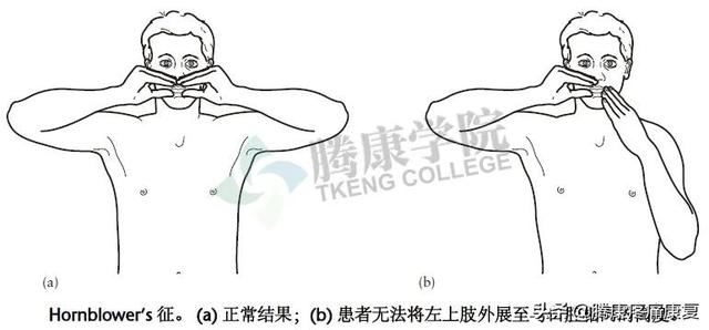 biceph，肩关节的特殊检查（bicep curl）