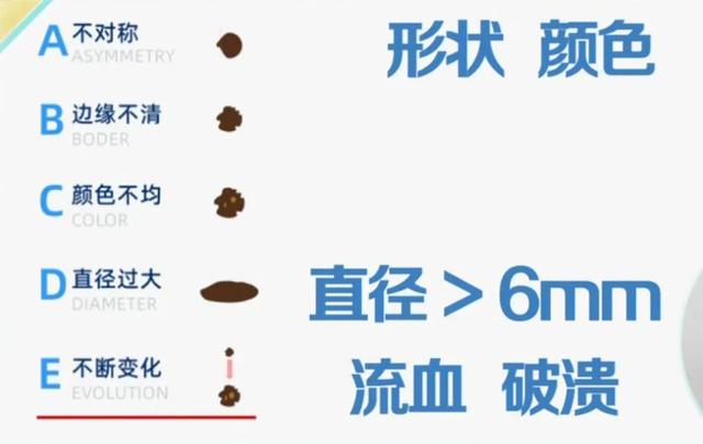 长红色的痣是有什么预兆，其中一种是肝癌的信号