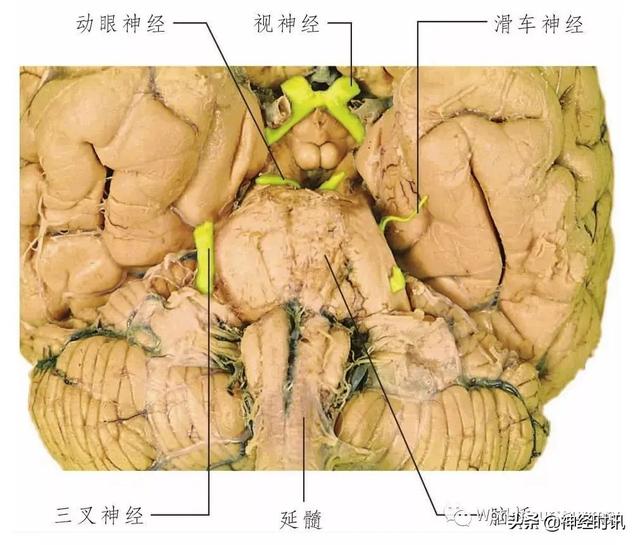 属于膜迷路的结构是，属于膜迷路的结构是蜗管蜗顶（彩图经典版│脑神经和脑神经核解剖）