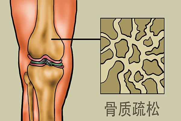 什么人不能喝茶，什么样的人不适合喝茶（老年人喝茶牢记“2不喝、3不做”）