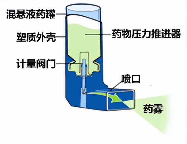 隔几分钟要深吸一口气才舒服，隔几分钟要深吸一口气才舒服怎么办（药师有话说——压力定量气雾剂的合理使用）