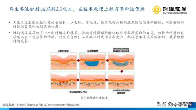 伊婉玻尿酸是韩国进口的玻尿酸吗，伊婉玻尿酸是哪个国家生产（从产品布局出发寻找下一个艾尔建）
