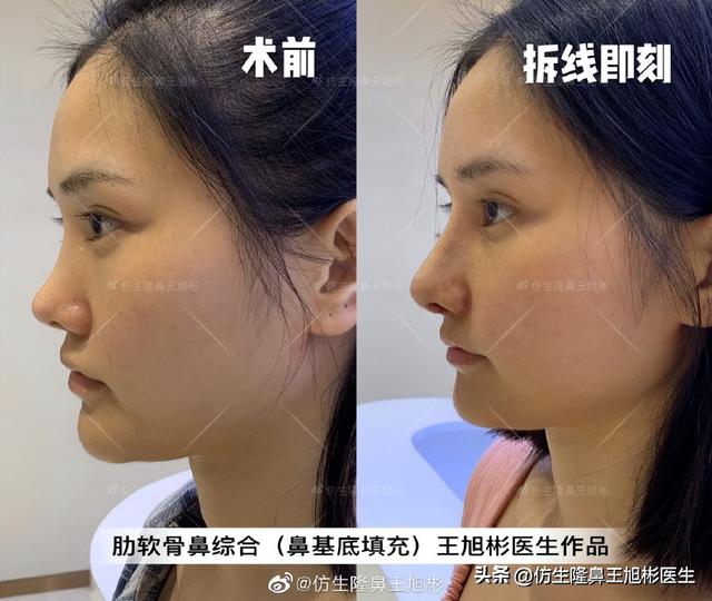 高级脸是什么意思，6种脸型不显老（“月亮脸”逆袭“高级脸”的不二法则是）