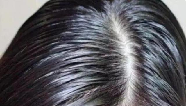 头发油怎么办快速解决，头发出油怎么办（头发油该怎么解决）