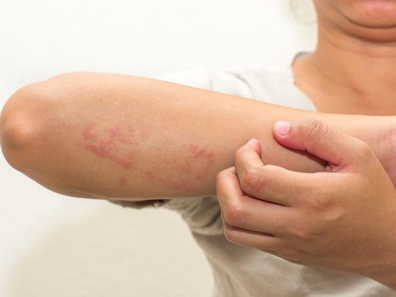 女人缺钙的10个征兆，女人严重缺钙的征兆（光从外表，能不能看出缺钙）