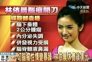 林依晨演的电视剧，林依晨和刘烨一起演的电视剧叫什么名字（林依晨：为了孩子备孕七年）