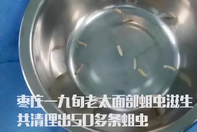 怎么能消除卫生间的蛾蚋幼虫，卫生间蛾蠓怎么根除（它发起飙来医生也怕）