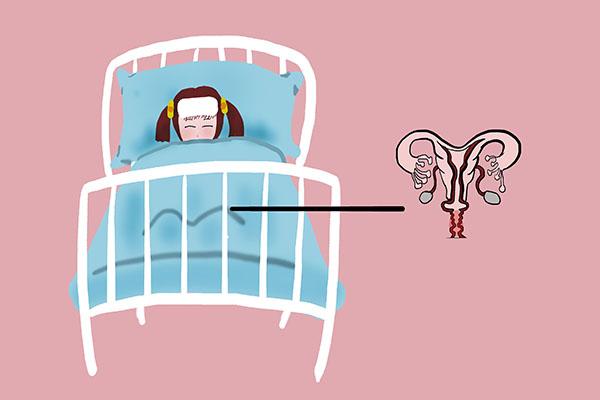 阴道镜检查疼吗，做阴镜一般都查什么病（医生：有2类人）