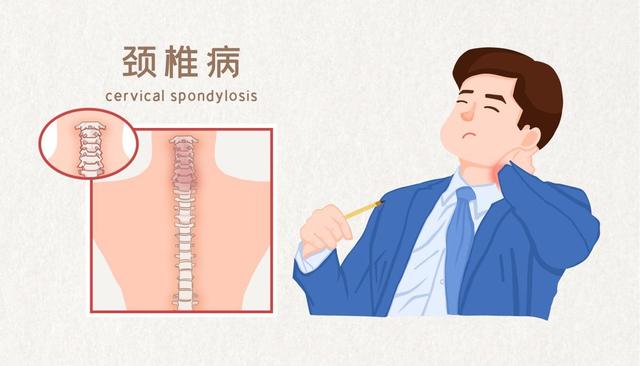 脖子落枕的說說,落枕怎麼治(到底你的頸部疼痛和活動受限是落枕還是