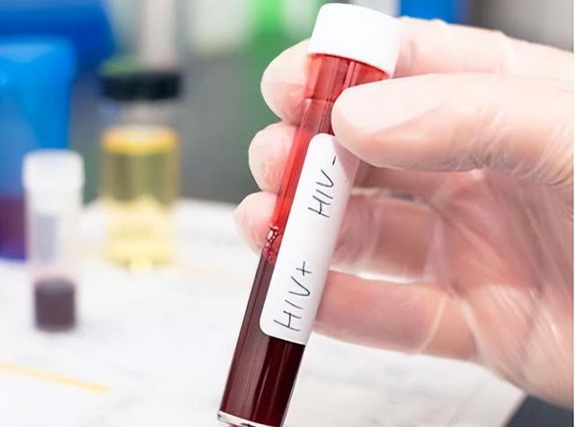 为什么医生自己不献血的秘密，为什么医生都不献血（献血到底有没有坏处）