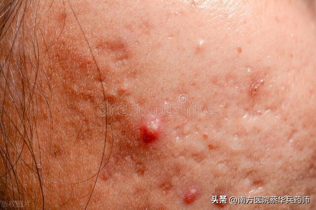 过路黄的功效与作用，过路黄的功效与作用！（用于排石汤；清热利湿能退黄）