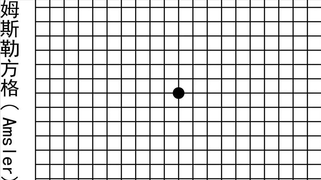 眼睛模糊是什么原因引起的(眼睛突然模糊了一阵又好了)插图(10)