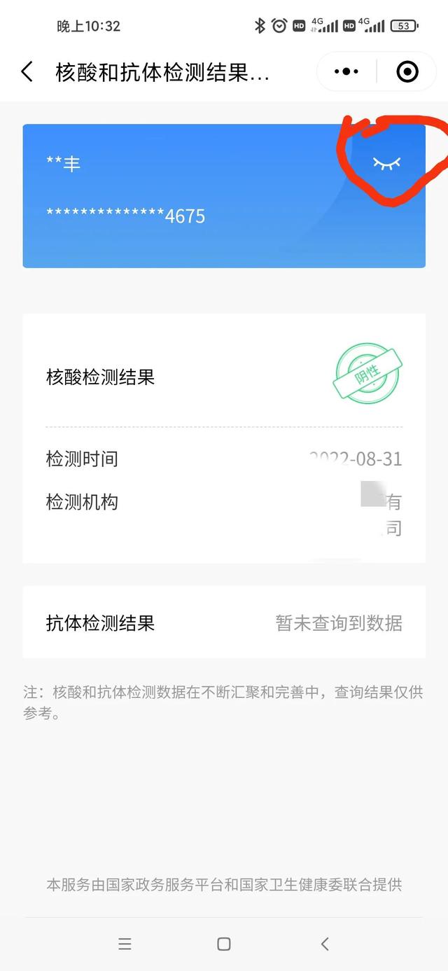 核酸纸质报告能自己打印吗，核酸纸质报告可以自己打印吗（纸质版核酸报告自己手机上完成）