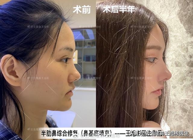 高级脸是什么意思，6种脸型不显老（“月亮脸”逆袭“高级脸”的不二法则是）