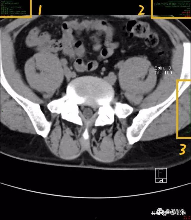 r和l哪个是左哪个是右，袜子r和l哪个是左哪个是右（竟然包含了这么多的信息）