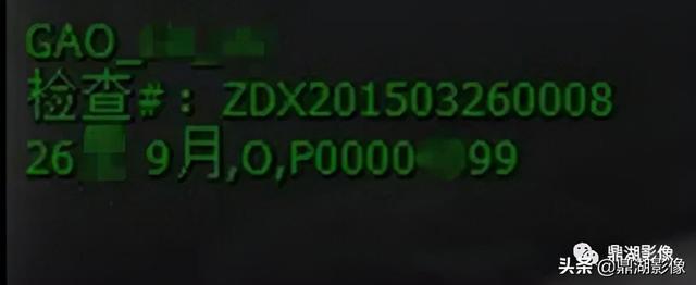 r和l哪个是左哪个是右，袜子r和l哪个是左哪个是右（竟然包含了这么多的信息）