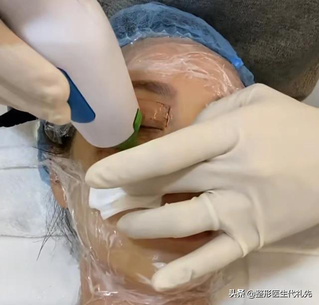 如何去除细纹，如何去除细纹和皱纹（整形医生总结<4点实用方案>）