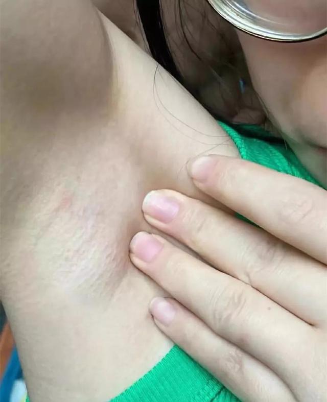 止汗露哪个牌子效果好，如何选择止汗剂（遗传狐臭实测8款）