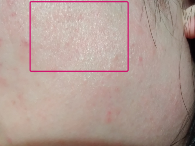 脸部能天天热敷吗，热敷脸有哪些功效与作用（面膜可以天天敷吗）